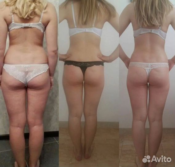 LPG идеальное тело- легко