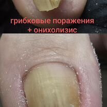 Подологический педикюр, Зеленоград