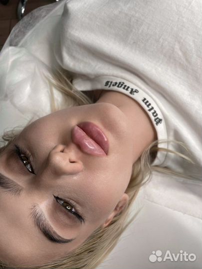 Увеличение губ