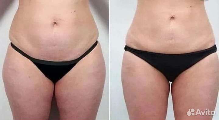 Коррекция фигуры