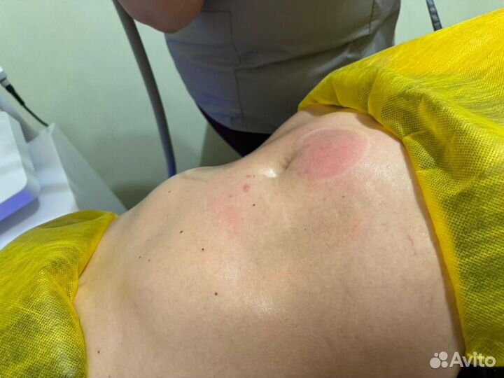 Срочное похудение