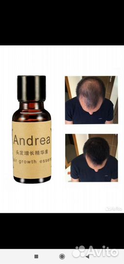 Сыворотка против выпадения волос