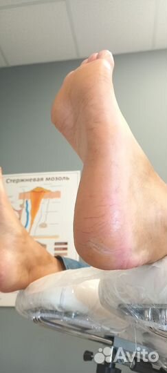 Педикюр на дому, Подолог, Выезд