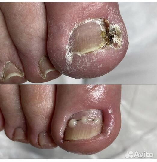 Модели на медицинский педикюр