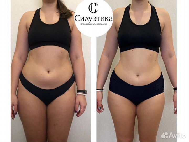 Массаж для похудения, Антицеллюлитный, роликовый