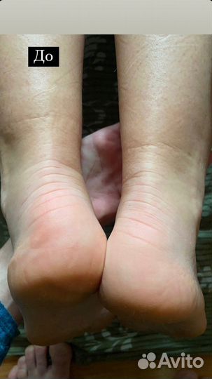 Массаж. Юмейхо Терапия