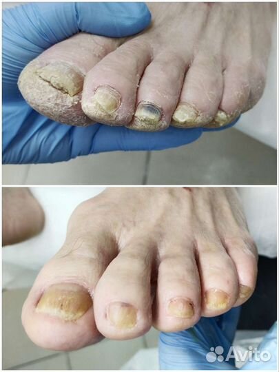 Услуги подолога