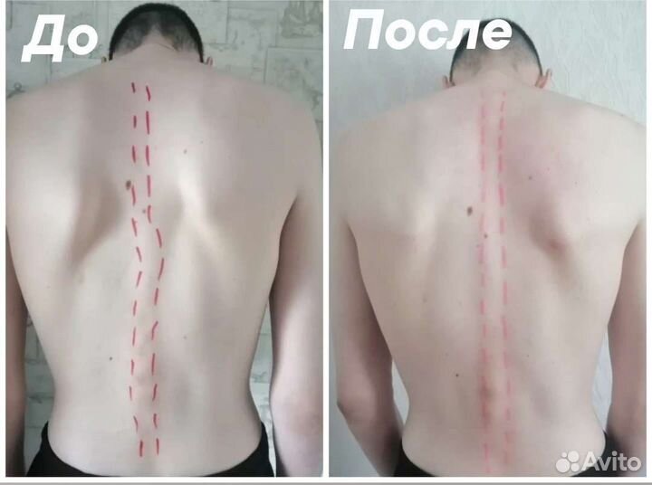 Ручной массаж