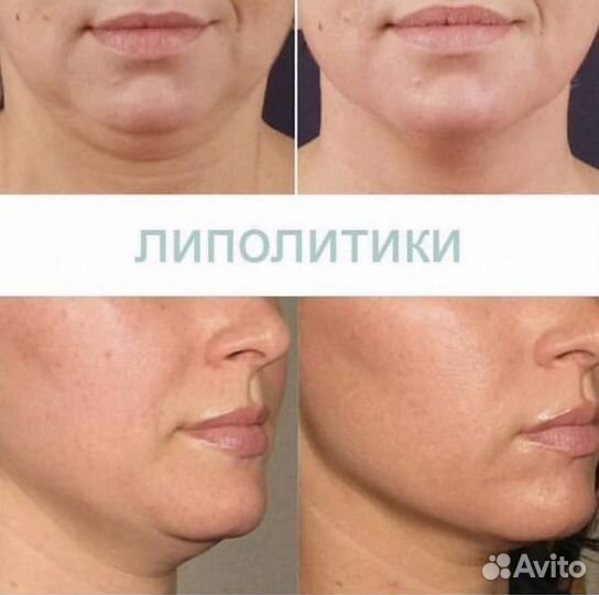 Full face (лицо под ключ) Ступино Московия