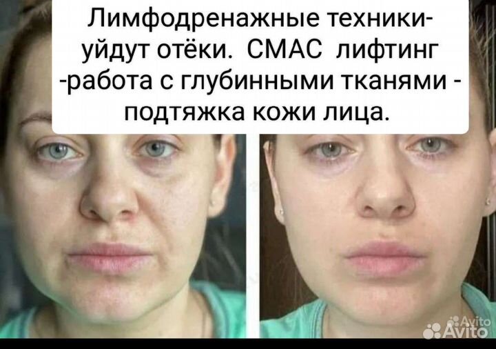 Лифтинг Массаж лица от Елены Бондаренко