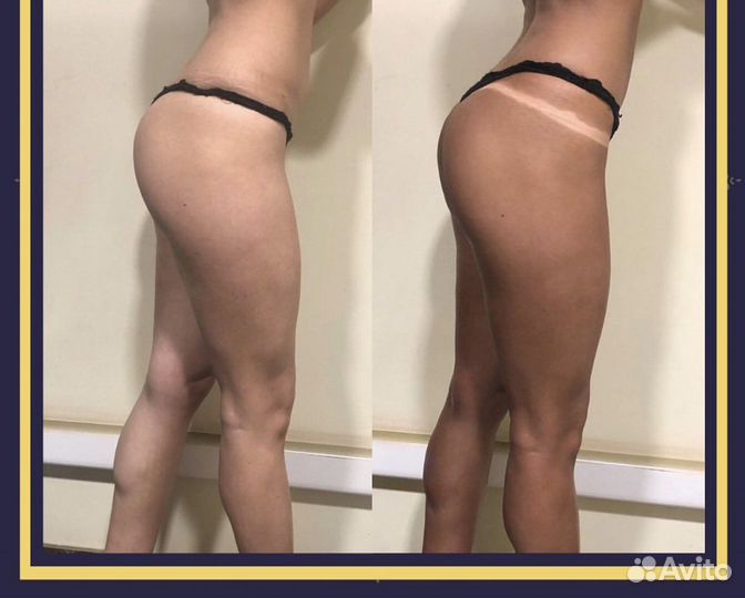 Моментальный загар