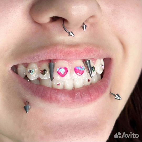 Установка скайсов, скайсы