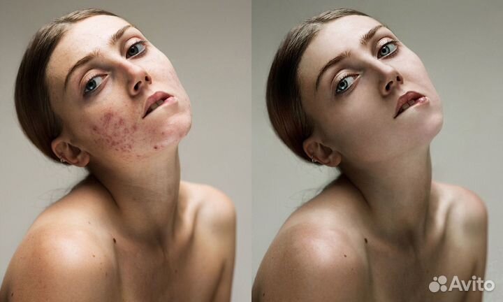 Плагины Retouch4Me для быстрой ретуши