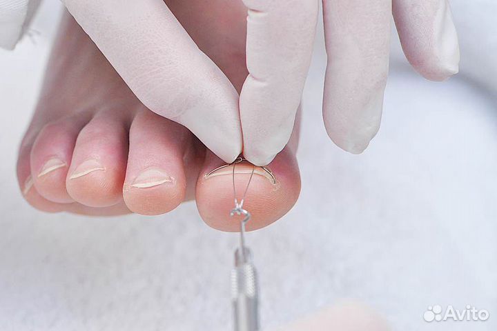 Лечебный педикюр