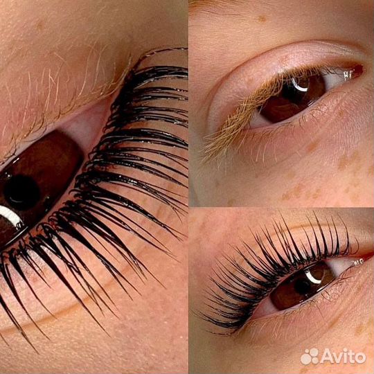 Брови и ресницы