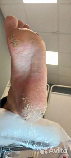 Педикюр на дому, Подолог, Выезд