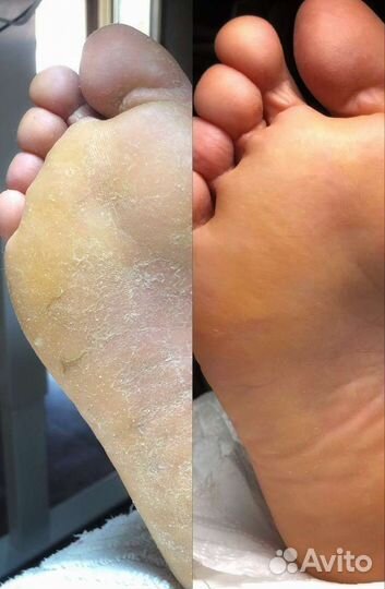 Аппаратный маникюр