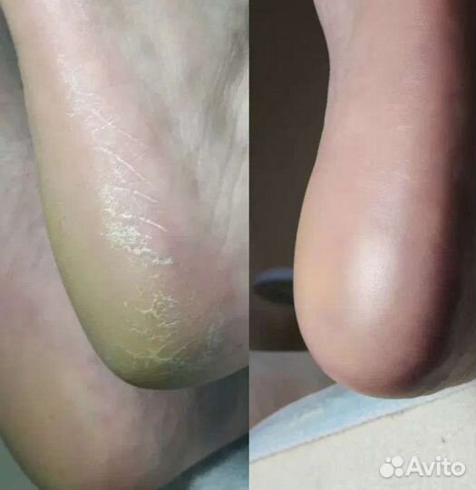 Маникюр, смарт педикюр