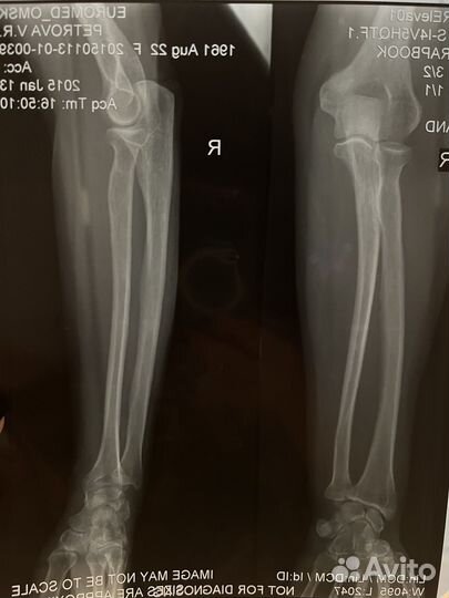 Рентгеновские снимки. 16 штук