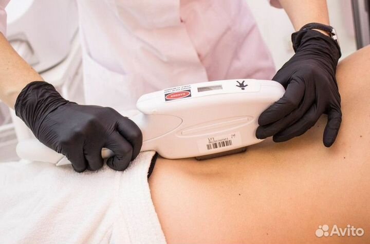 Лазерная эпиляция с клиентами — бизнес готов