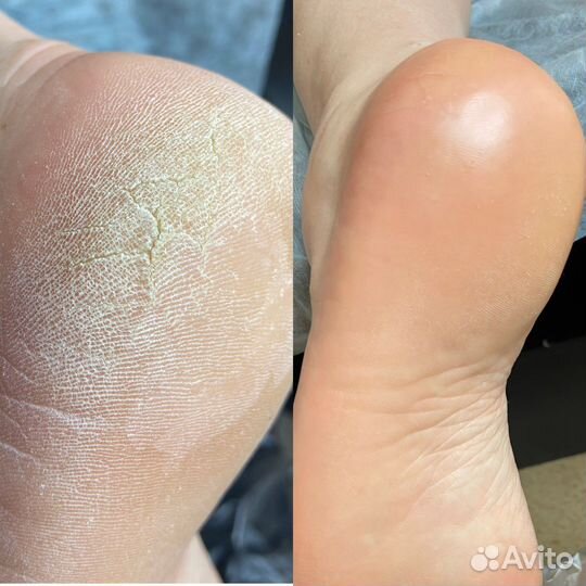 Маникюр гель лак