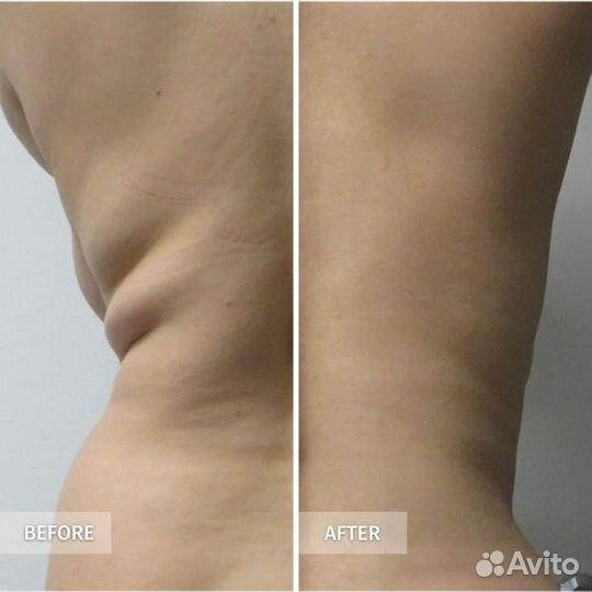 Корректирующий массаж