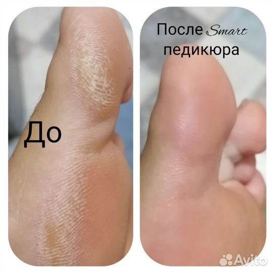 Маникюр и педикюр