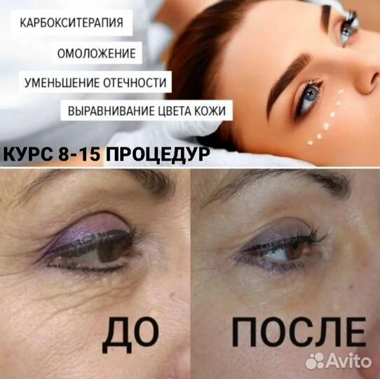 Услуги косметолога