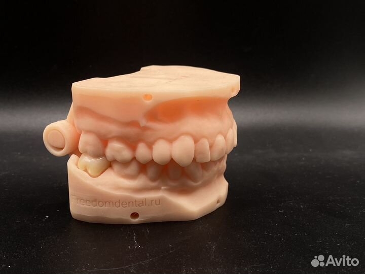 Коронка наготова от интраорального скана