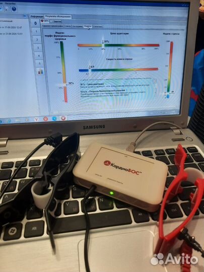 Диагностический терапевтический кардиобос сердце