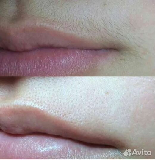 SPA-шугаринг/ваксинг