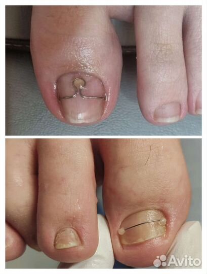 Услуги подолога