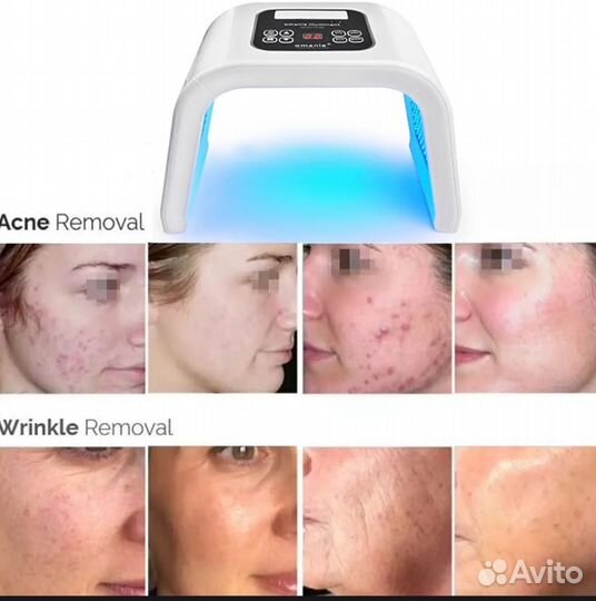 Аппарат косметологический