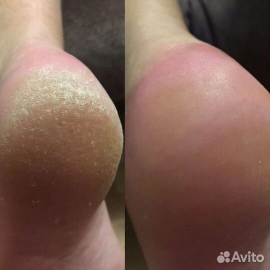 Красота и здоровье