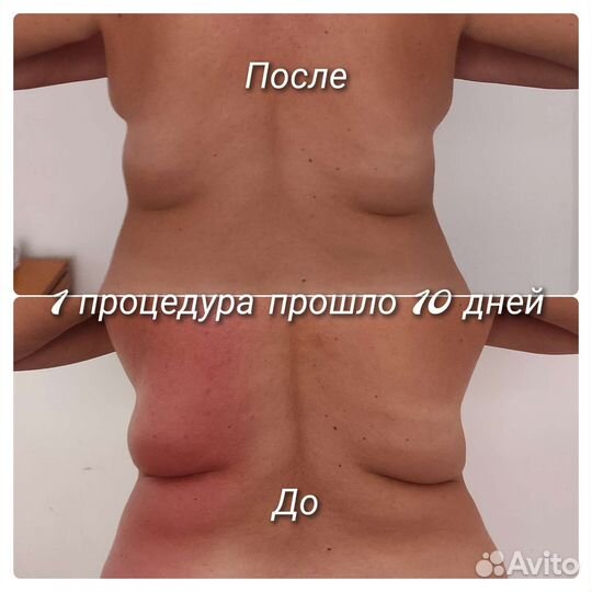 Массаж для женщин