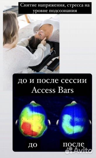 Массаж Access Bars (Сочи, Адлер, Красная Поляна)
