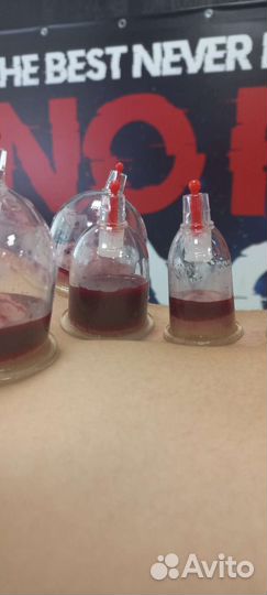 Массаж / Массаж на выезд / Мануальный массаж