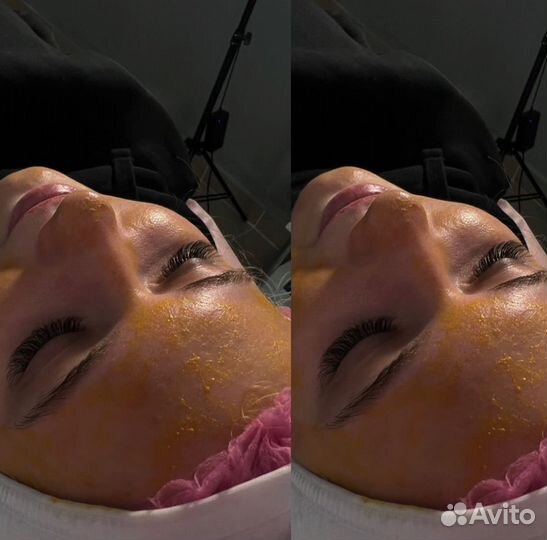 Услуги косметолога