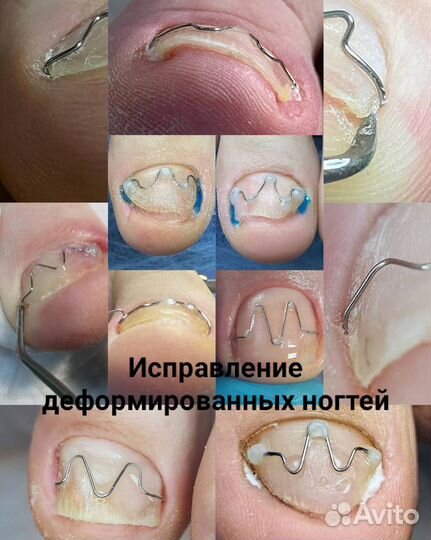 Мастер педикюра, подолог