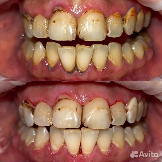 Гигиенист стоматологический