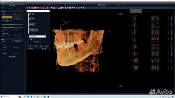 Invivo Dental 7.1 full 2023