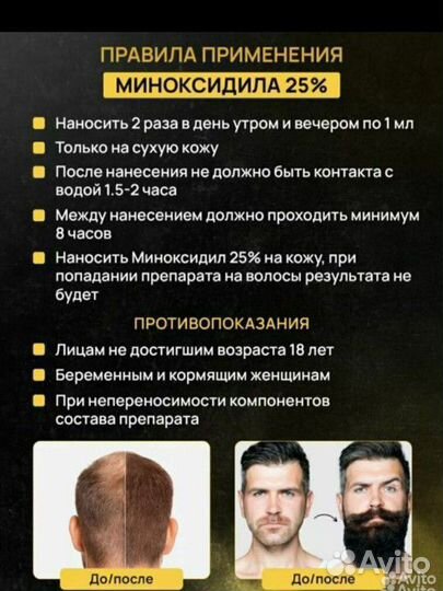Миноксидил 25%