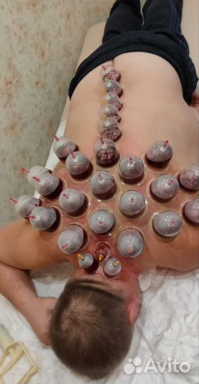 Пиявки медицинские