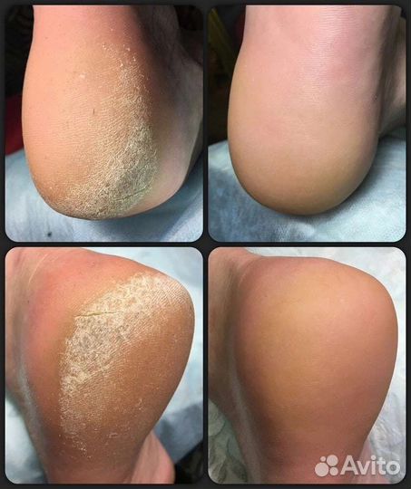 Красота и здоровье