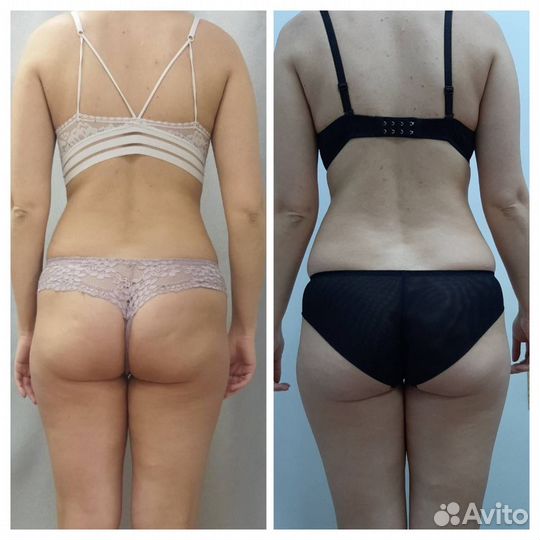 Kорреkция фигуры детокс, снимаем отечность