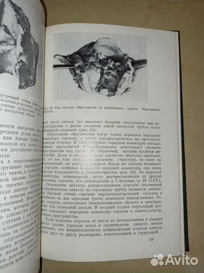 Злокачественные опухоли полости рта. Пачес. 1988