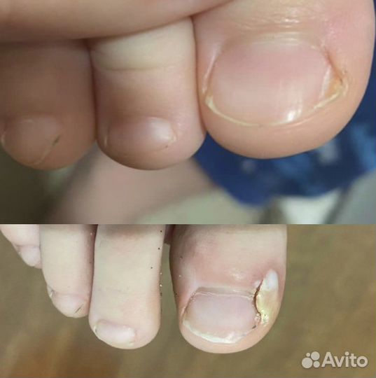 Подолог (сложные ногти и стопы)