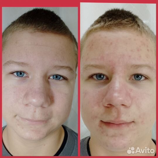 Косметолог эстетист, бровист