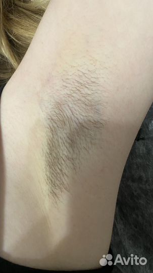 Шугаринг на дому