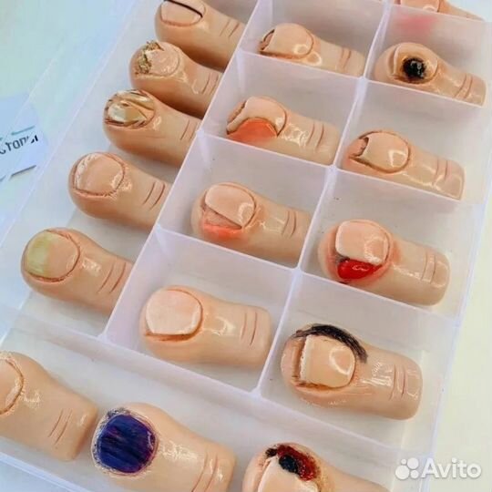 Подология/ Подолог Москва ул. Малая Дмитровка 25